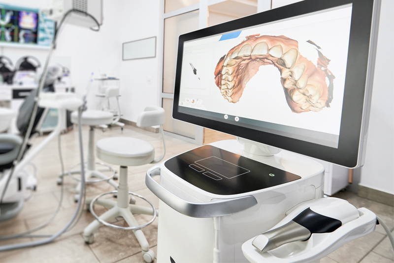 Intra-Oral Scanner in New Smyrna Beach